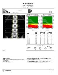 骨密度　腰椎