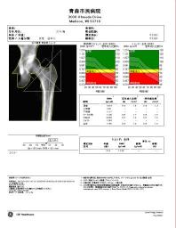 骨密度　大腿骨頭