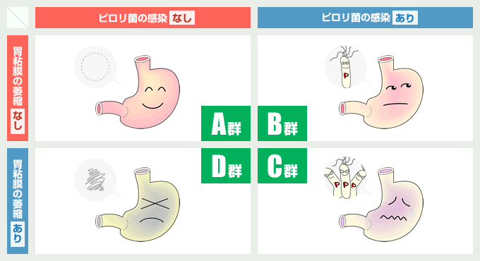 ABC分類